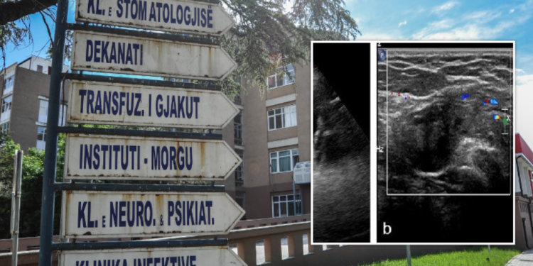 E rrallë: 67-vjeçari kosovar që ka organe gjenitale mashkullore dhe femërore
