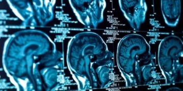 Një sëmundje e mistershme po prek gjithmonë e më shumë të rinjtë