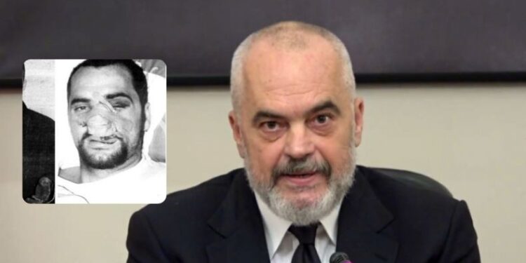 Kush e rrahu Edi Ramën në vitin 1997? – Dëshmia e tij: Donin të më vrisnin