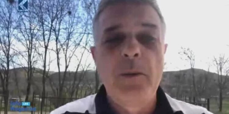 Shqiptarët në veri flasin pas sulmeve ndaj policisë: Ka ndodhur shumë afër, nuk frikësohemi sepse ne që nga pas lufta jetojmë kështu
