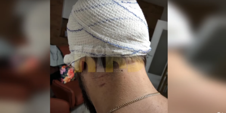 “Më kanë sjellë deri kur i ka ra bishti çekiçit” – Rrëfimi i vushtrriasit Muhamet Peci për rrahjen e rëndë (Video)