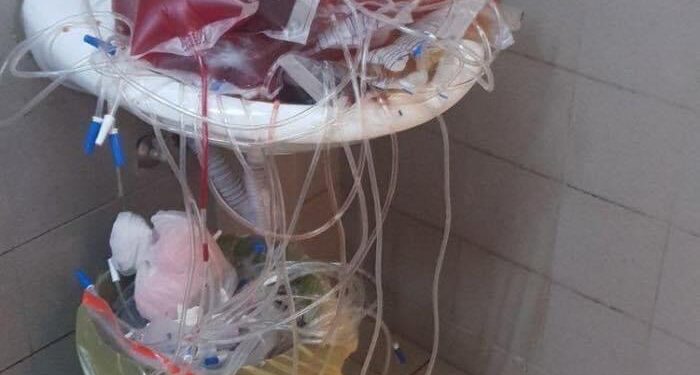 E tmerrshme: Pamje nga QKUK, higjiena larg çdo niveli