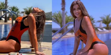 Arjola Demiri reagon pas kritikave për celulitin: Jam nënë e tre fëmijëve