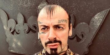 Me fashë në këmbë: Publikohet fotografia e Vali Corleones pas plagosjes