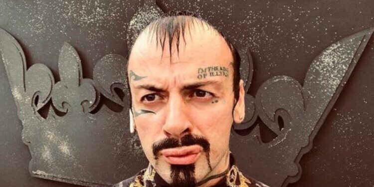 Me fashë në këmbë: Publikohet fotografia e Vali Corleones pas plagosjes