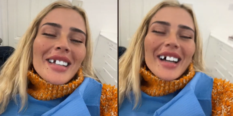 Loredanës i bie dhëmbi, çfarë po ndodh me reperen?