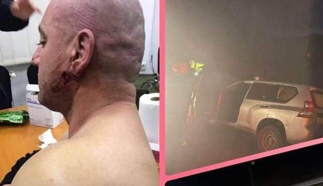 Sveçla i reagon Vuçiqit duke i postuar fotografitë e policit të plagosur në veri