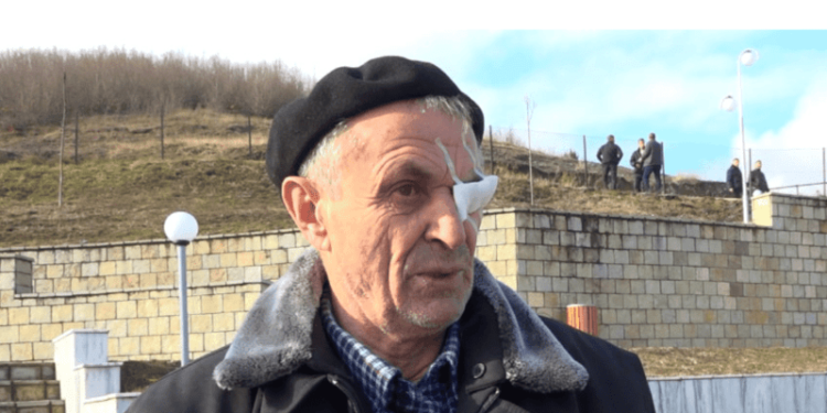 I mbijetuari i masakrës së Reçakut rrëfen tmerrin: I kanë lënë pa sy e pa zemër, ka pas edhe pa kokë