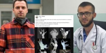 Gazetari e përgënjeshtron mjekun që publikoi rentgenë të lëndimeve nga mjetet piroteknike: Imazhet e rentgenit nuk janë në Kosovë, është një montazhë