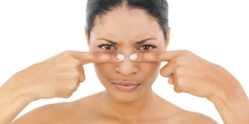 Si të shpëtojmë nga pikat e zeza në hundë?