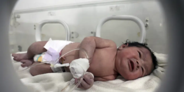 Foshnja që lindi nën rrënoja tani ka një emër: Aya, arabisht për “një shenjë nga Zoti”