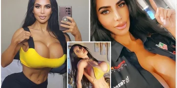 Modelja ‘sozi’ e Kim Kardashian vdes gjatë operacionit të dështuar plastik (fotot)