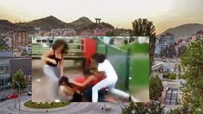 E turpshme: Dy femra bëjnë për spital një femër tjetër në Mitrovicë
