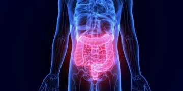 Studimi: Dy shkaktarët e kancerin e zorrës,”fshihen” në pjatat tona