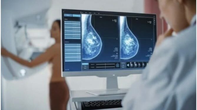 Inteligjenca artificiale zbuloi kancerin e gjirit para se dy mjekë të bënin mamografinë