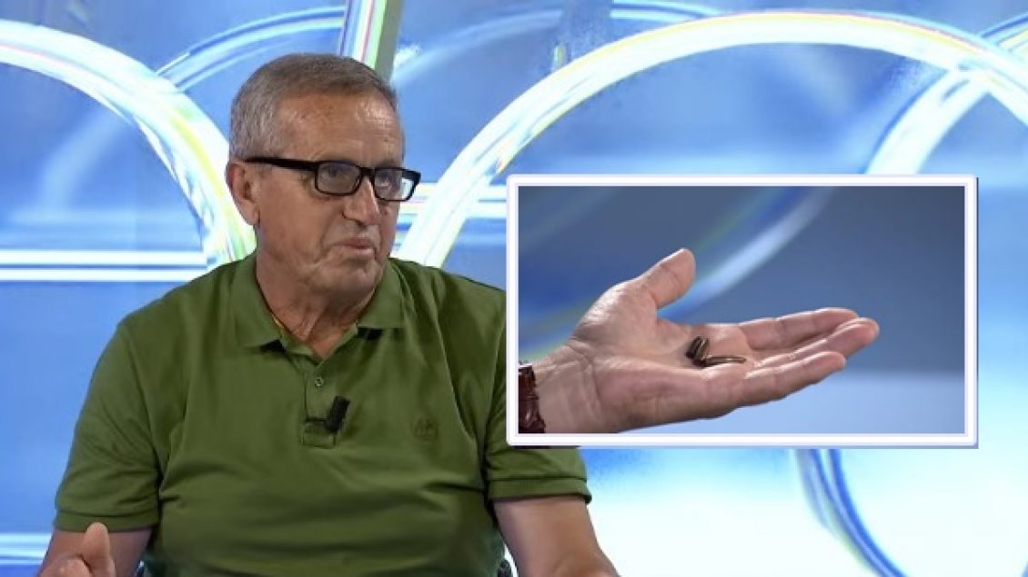 I mbijetuari i luftës i ruan ende plumbat të cilët u nxorën nga trupi i tij