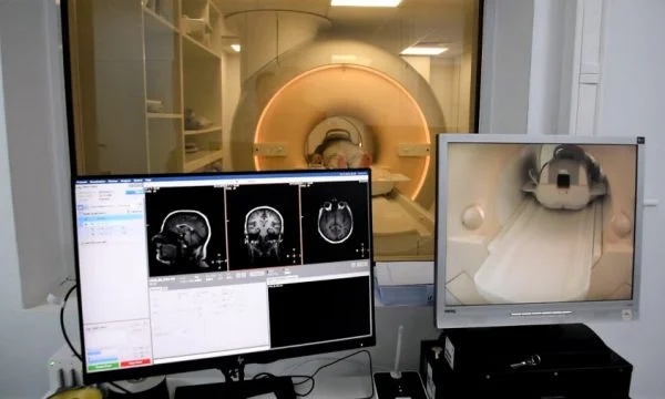 Shkurtohet lista e pritjes për rezonancë magnetike në Radiologji, mbi 72 pacientë morën shërbime për gjashtë muaj