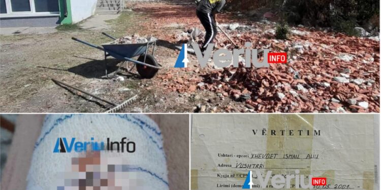 Ish-ushtar i tri luftërave sulmohet në vendin e punës në Vushtrri, punëtori i shkollës sulmohet nga punëkryesi (Foto)