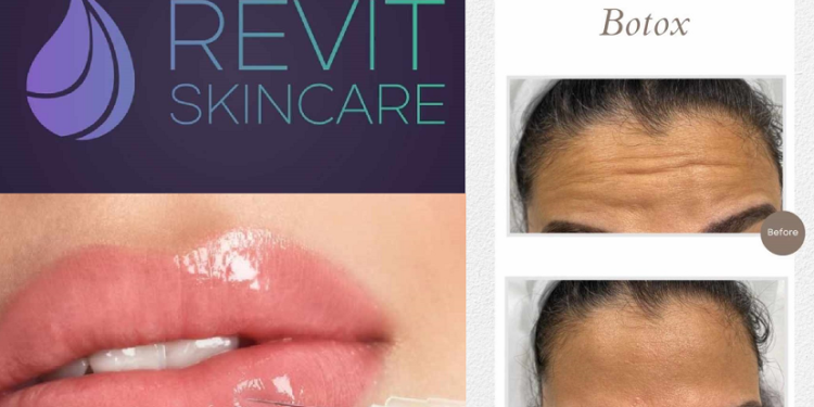 ‘Revit Skincare’ ofron shërbime ekskluzive për përmirësimin e bukurisë, trajtime estetike, dermatologjike dhe kozmetike për fytyrën dhe trupin