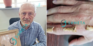 Publikohen fotografitë e mustaqeve të Adem Jasharit dhe kockave të gishtit të Isa Boletinit