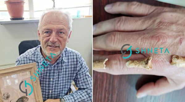Publikohen fotografitë e mustaqeve të Adem Jasharit dhe kockave të gishtit të Isa Boletinit