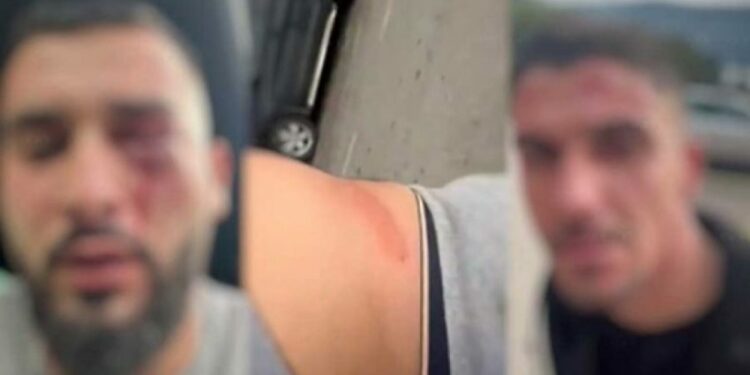 Rrahja e shqiptarëve në Mal të Zi, Filipoviq: U vunë në shënjetër për shkak të kombësisë