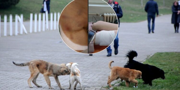 Qeni endacak sulmon një grua në Prishtinë, përfundon në spital