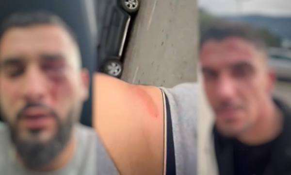 Rrëfehet Doris Kopaci, njëri prej shqiptarëve të sulmuar në Mal të Zi: Na ndaluan duke na sulmuar