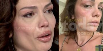 Publikohen fotot: Kështu u rrah ish-miss Kosova nga burri i saj