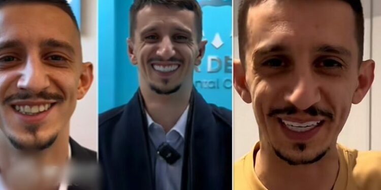 “Dhëmbët, flokët e veshët” – Gani Gërmia me ndryshim drastike në pamje