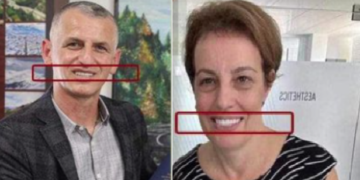 Pas implantit të Durmishit, qytetarët tallen edhe me ndërhyrjet e Gërvallës