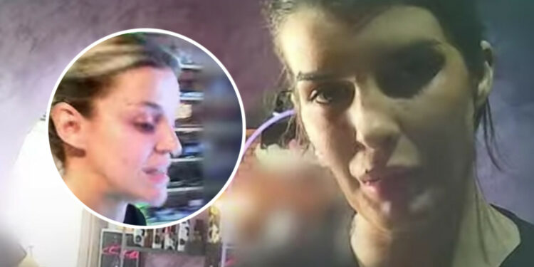 “Prej Emergjencës erdha këtu”, mjekja ik nga QKUK-ja, bën botox e fillera te ‘frizerka’ (Video)
