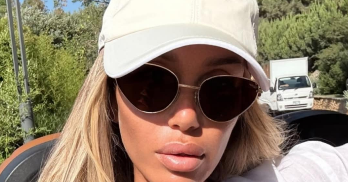 Adelina nis pushimet në Turqi, shfaqet ‘zjarr’ nga plazhi