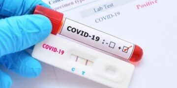 Rriten rastet me Covid-19 në Shqipëri