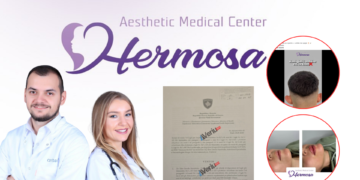 U zbuluan duke ofruar shërbime dermatologjike pa licencë, Inspektorati gjobiti rëndë doktorët e Klinikës “Hermosa” (Dokument)