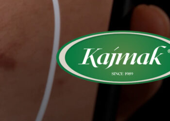 Pa kontratë dhe me pretendime se u sulmua fizikisht – rrëfimi i punëtorit që akuzon drejtorin për dhunë në kompaninë Kajmak