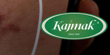 Pa kontratë dhe me pretendime se u sulmua fizikisht – rrëfimi i punëtorit që akuzon drejtorin për dhunë në kompaninë Kajmak Sh.P.K.