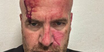 LVV: Sami Lushtaku dhe truprojat e tij sulmuan brutalisht Hyni Mehanin