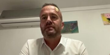 Mehani flet sërish për sulmin: Më goditën me telefon, më sulmuan edhe truproja!