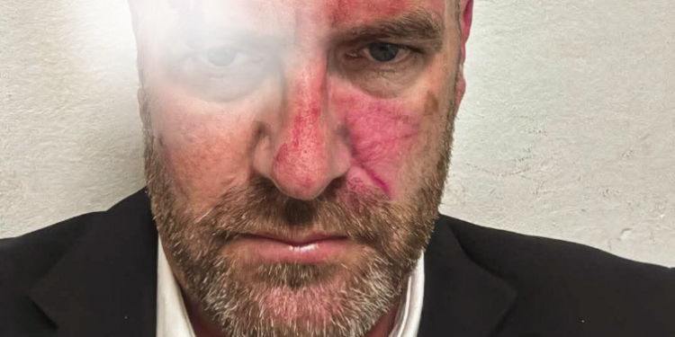 LVV: Sami Lushtaku dhe truprojat e tij sulmuan brutalisht Hyni Mehanin (Pamje +18)