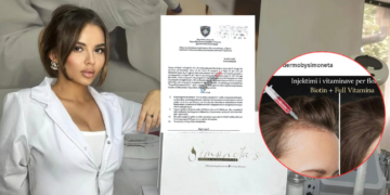 “Derma By Simoneta” gjobitet 5 mijë euro për Botox, fillerë e mezoterapi pa licencë, por vazhdon aktivitetin edhe pas vendimit