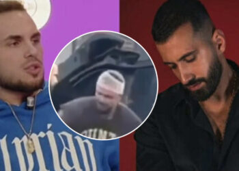 Dje u raportua se është rrahur, sot dalin pamjet e para të Edit me fashë në kokë (Video)
