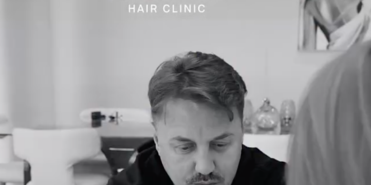 Blero i kënaqur me rezultatin, tregon pamjen e re pas trajtimit të fundit në ‘Ozone Clinic’