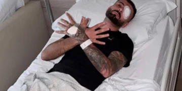 U plagos në sy gjatë protestës, reagon Erjon Vishkulli para operacionit në Itali: Zoti do të krijojë lehtësim pas vështirësive