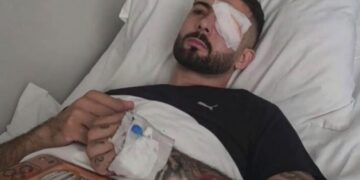 “Shqipëria e shqiptarëve”/ U dërgua në Itali për trajtim pasi u plagos me plumb gome në sy, reagon Erjon Vishkulli