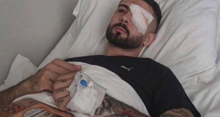 “Shqipëria e shqiptarëve”/ U dërgua në Itali për trajtim pasi u plagos me plumb gome në sy, reagon Erjon Vishkulli