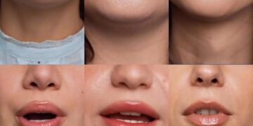 Bukuria ka një destinacion – Facial AM zgjeron shërbimet edhe në kirurgjinë estetike