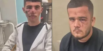 Ngjarje e rëndë në Shkup, dy të rinj dyshohet se u rrahën brutalisht nga Policia