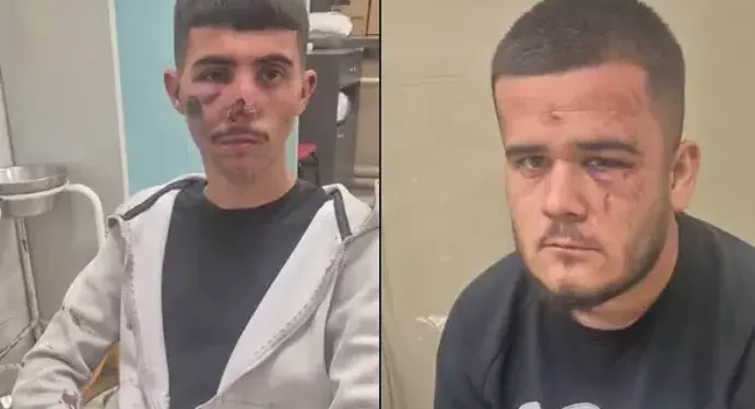 Ngjarje e rëndë në Shkup, dy të rinj dyshohet se u rrahën brutalisht nga Policia